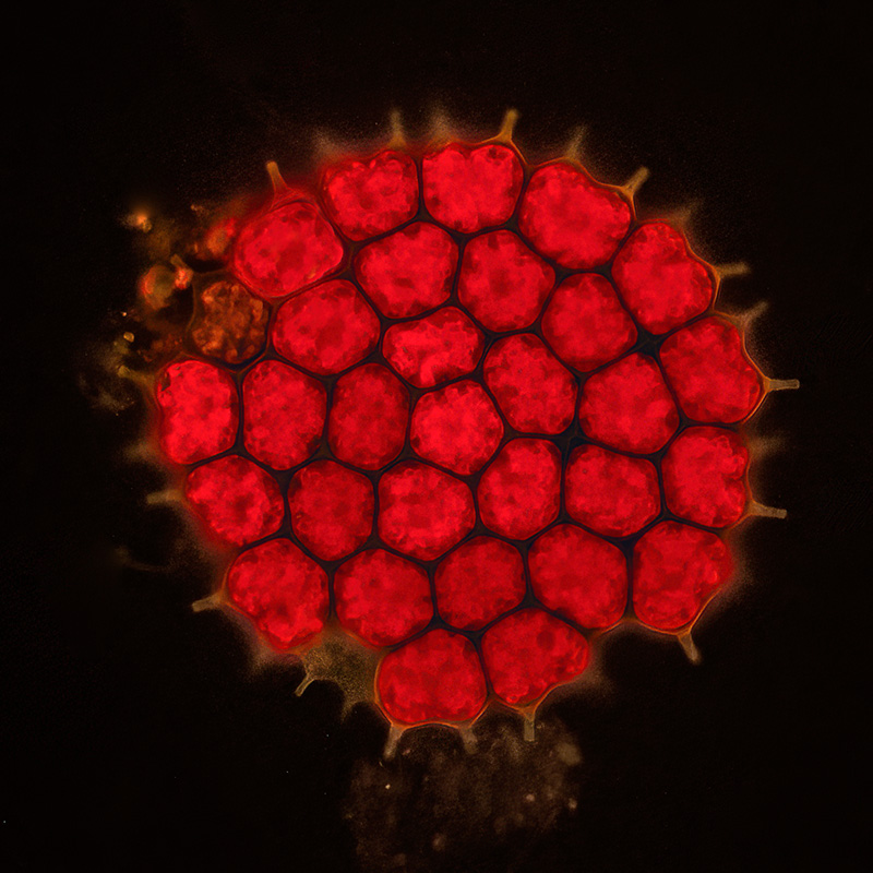 Auflicht-Fluoreszenz ist ebenfalls ausgerüstet. Ich mache damit erst einige Versuche