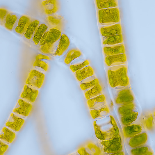 Mit allen Objektiven ist es möglich Hellfeld zu mikroskopieren