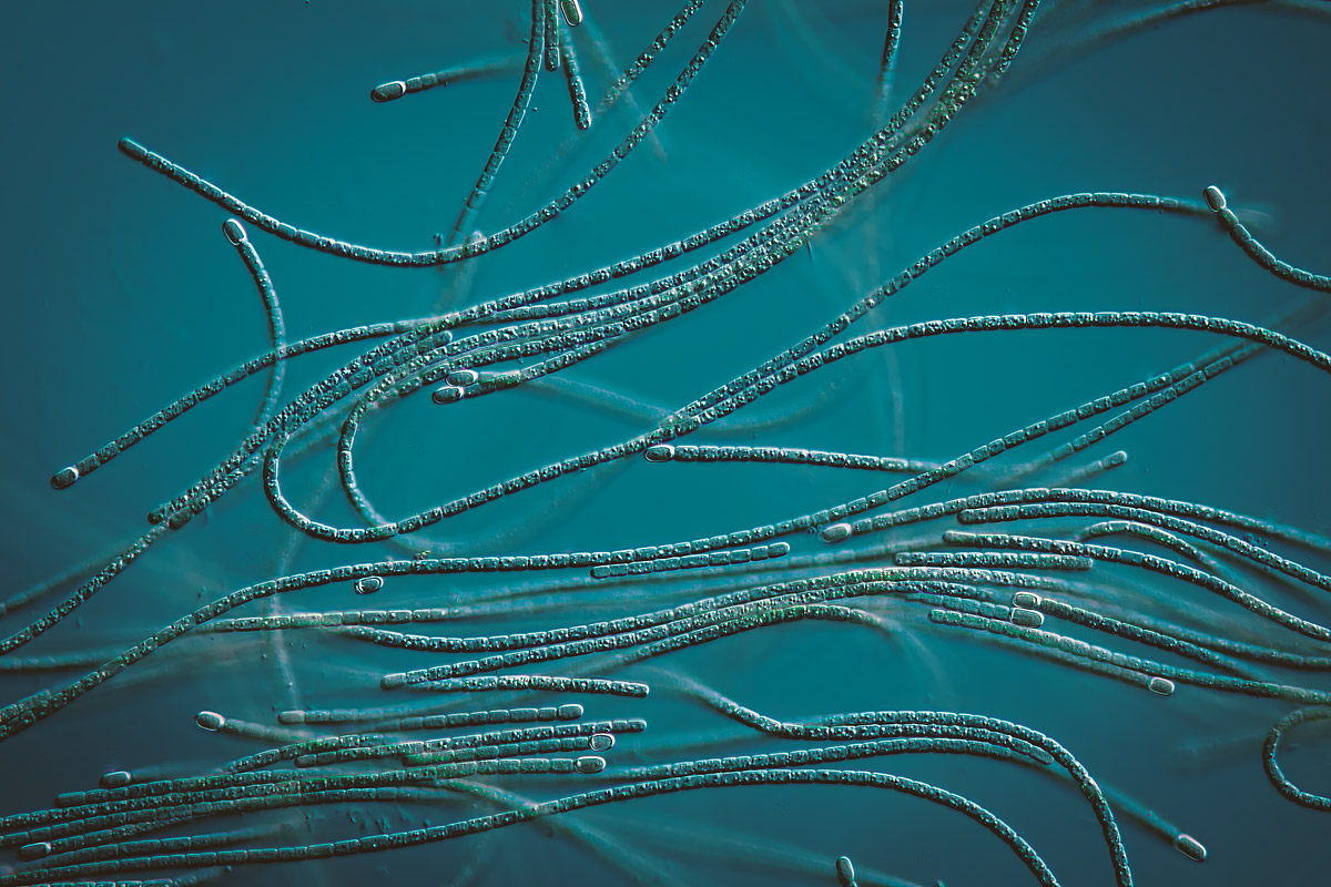 Blaualgen als mikroskopische Aufnahme