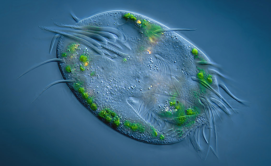 Euplotes unter dem Mikroskop