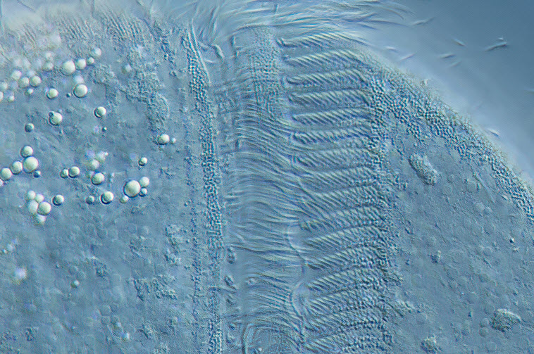 Brachonella spiralis