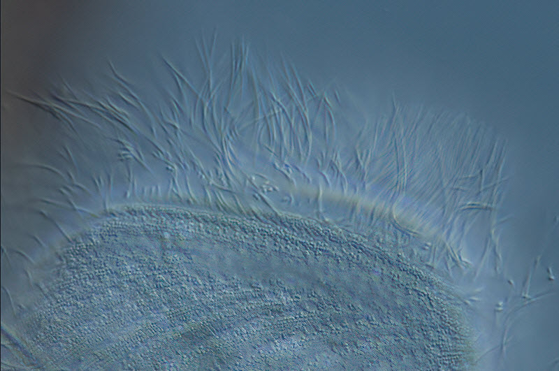 Brachonella spiralis