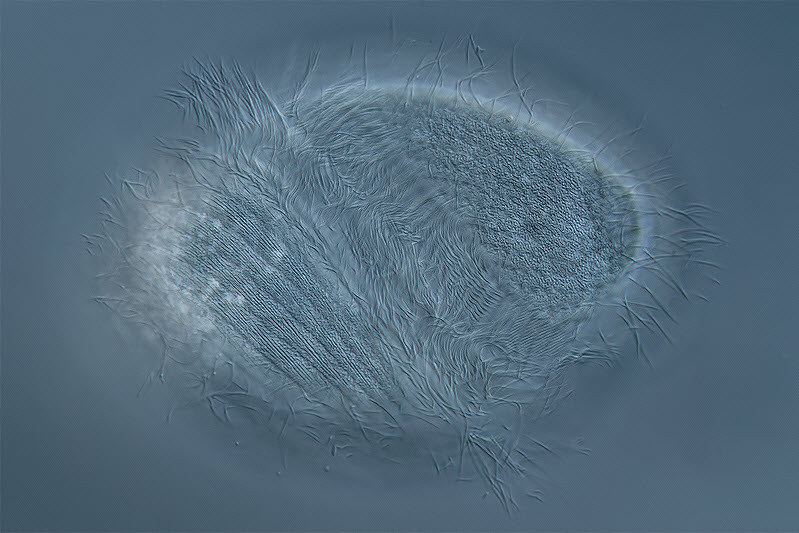 Brachonella spiralis