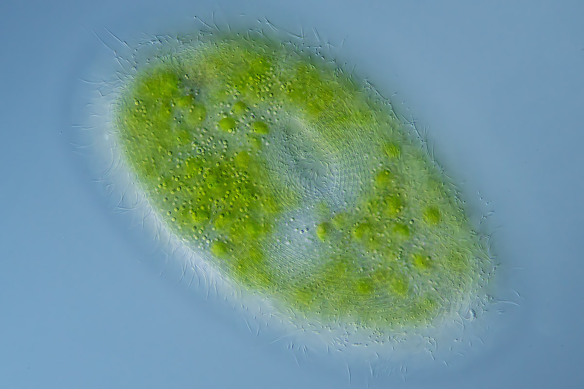 Paramecium bursaria