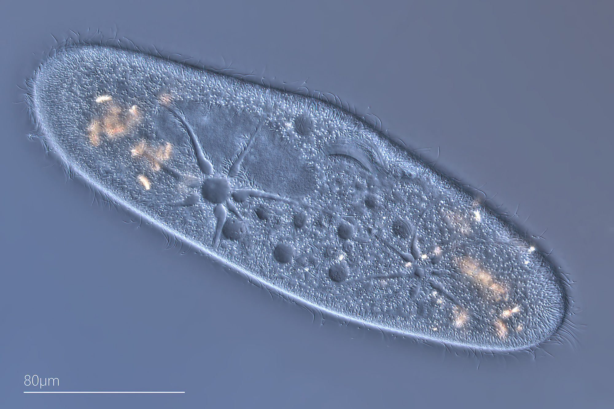Paramecium caudatum